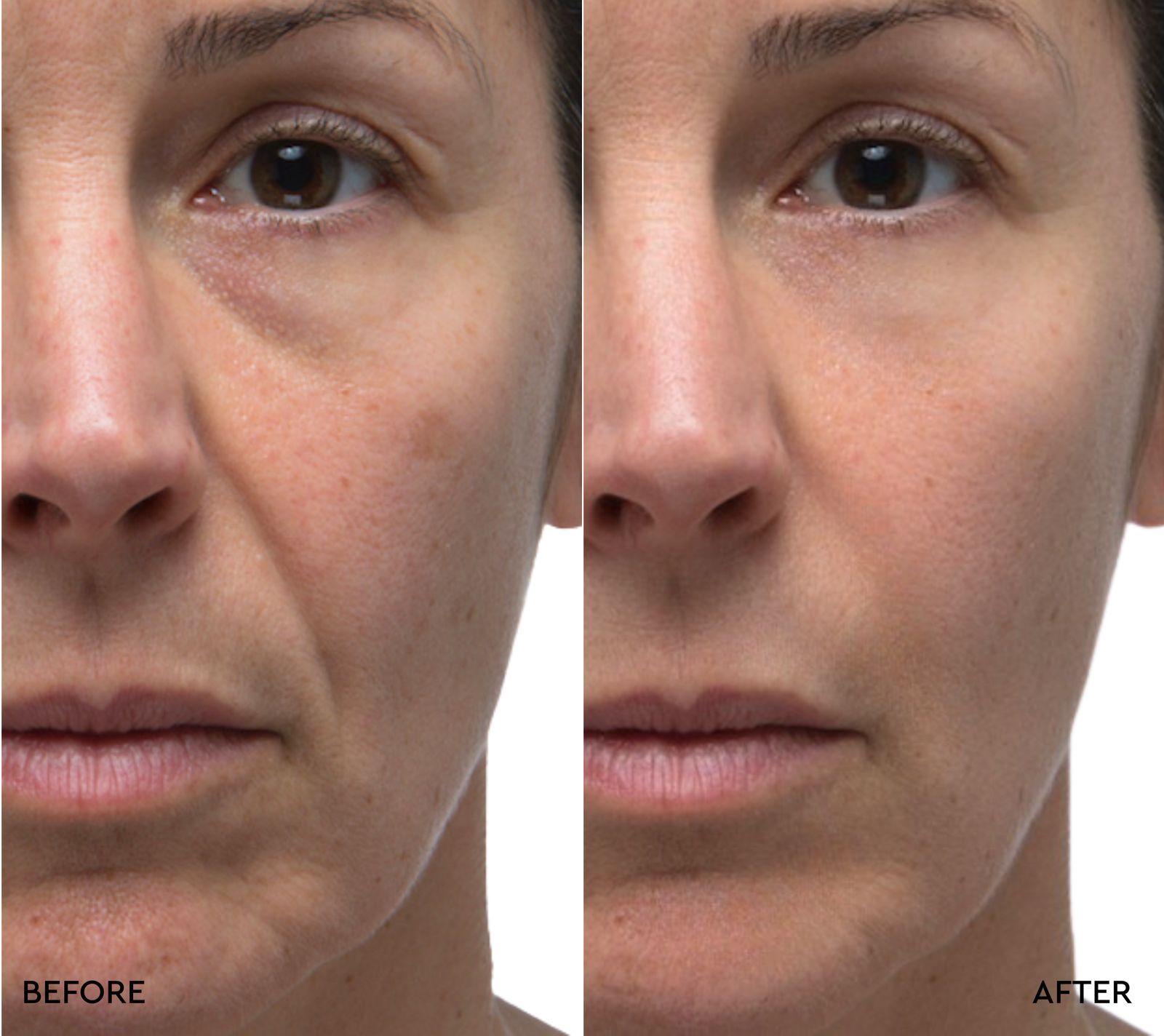 Retinol Rescue Overnight Cream